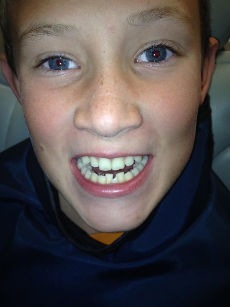  or railroad tracks, but we think he looks pretty cool in braces